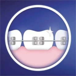 Oral B Opzetborsteltjes Ortho Care Essentials 25 Oral B Opzetborsteltjes Ortho Care Essentials -Oral B Aanbiedingen Winkel oral b opzetborsteltjes ortho care essentials wit 5